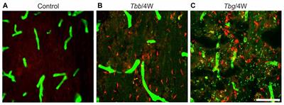 Neural Damage in Experimental Trypanosoma brucei gambiense Infection: The Suprachiasmatic Nucleus